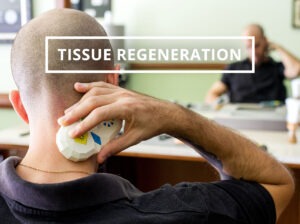 Tissue regeneration image